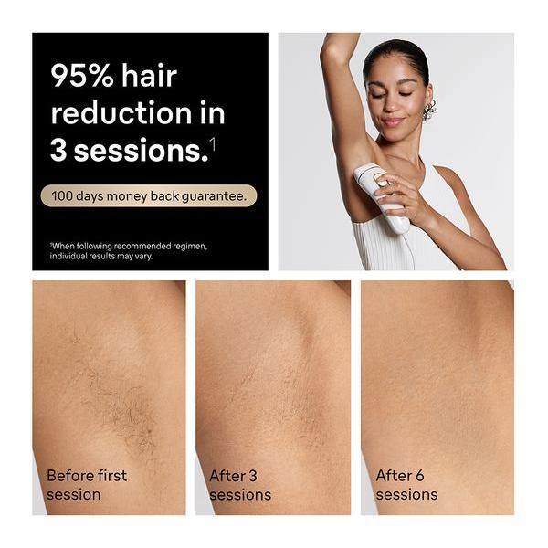 BRAUN Silk-expert Pro 5 PL5221 IPL Hair Removal System - White